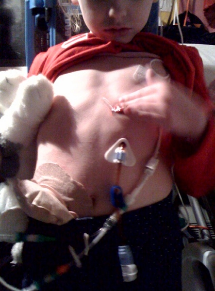 Daisy with tubes attached