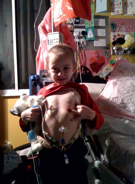 Daisy with tubes and machine attached